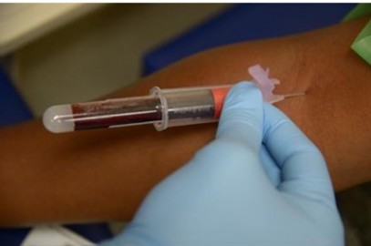Microbial DNA in Patient Blood May be Tell-Tale Sign of Cancer