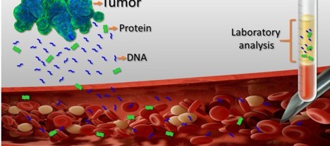 Rethinking Cancer: Could Microbial DNA in Your Blood Be a Sign of Cancer?