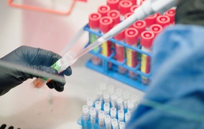 U.S. rushes to fill void in viral sequencing as worrisome coronavirus variants spread