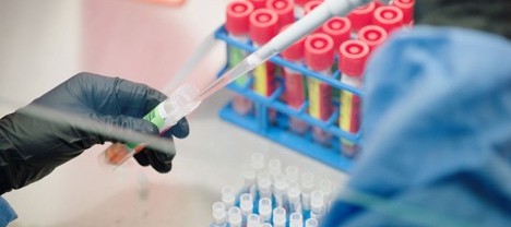 U.S. rushes to fill void in viral sequencing as worrisome coronavirus variants spread