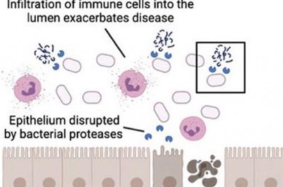 Digitized Number 2: Stool Samples Reveal Microbial Enzyme Driving Bowel Disease