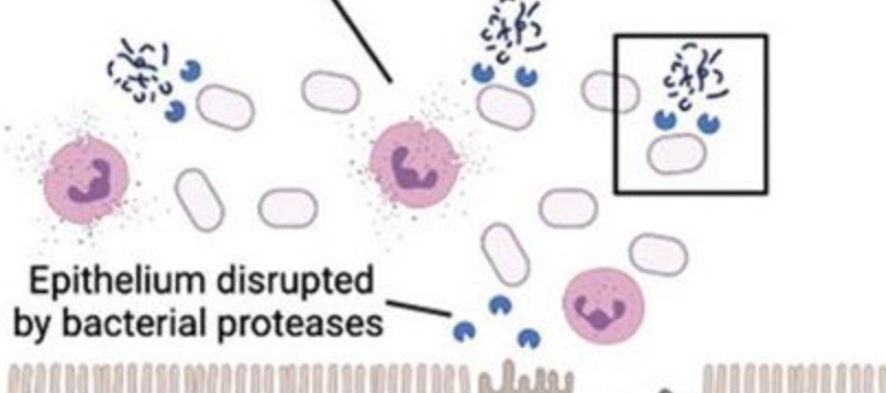 Digitized Number 2: Stool Samples Reveal Microbial Enzyme Driving Bowel Disease