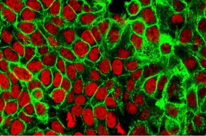 Fungi and cancerous tumours: California scientists uncover association