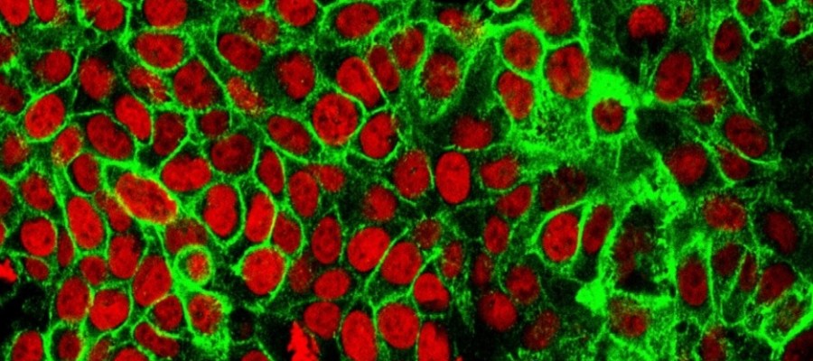 Fungi and cancerous tumours: California scientists uncover association